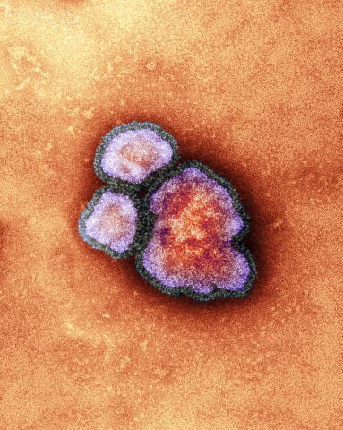 Measles virus particles